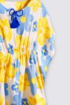 Juicy-Dress—Yellow-Model—1