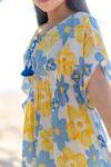 Juicy-Dress—Yellow-Model—1